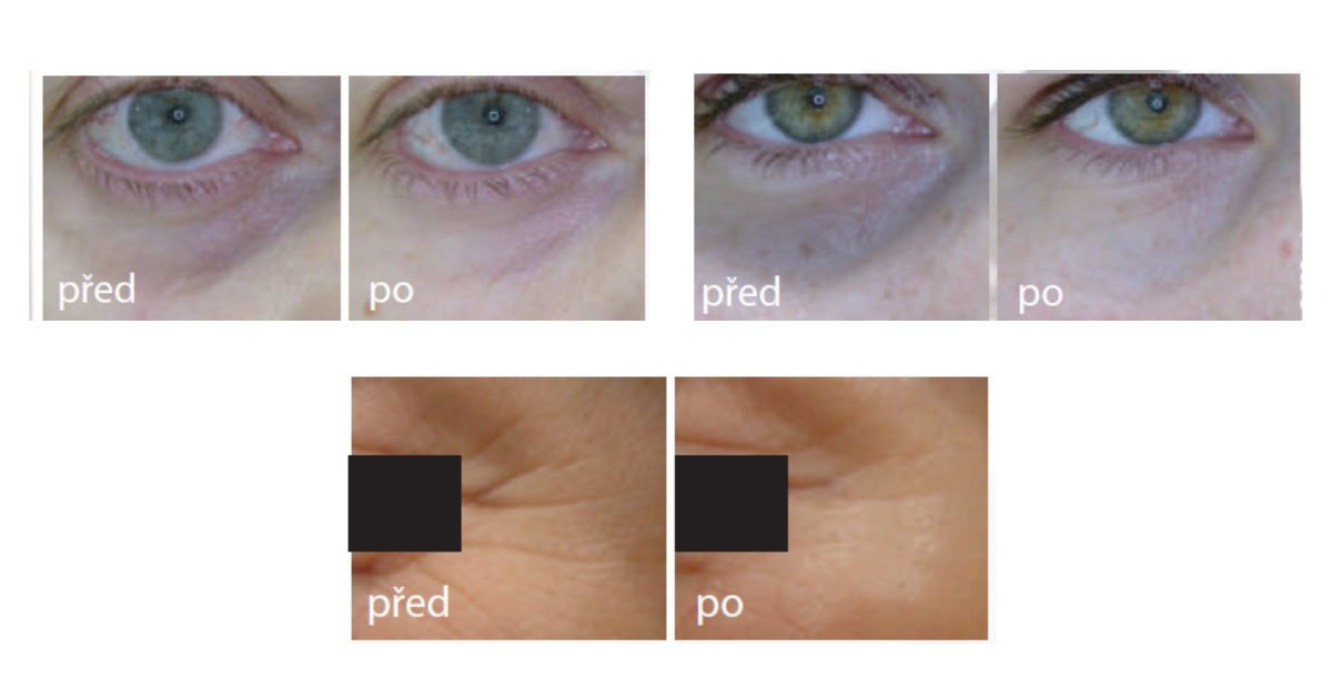 klinicka data eyecell genosys